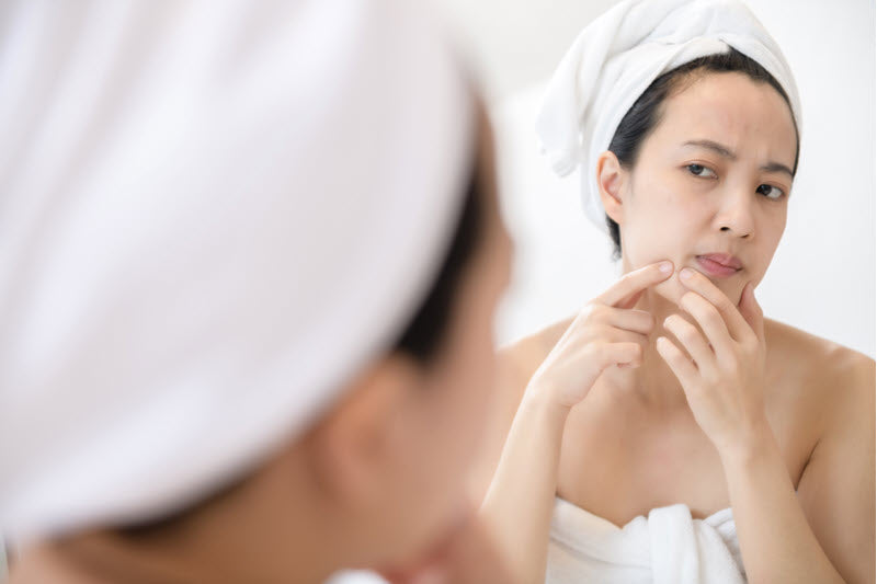 Skin Purging: Things to Know